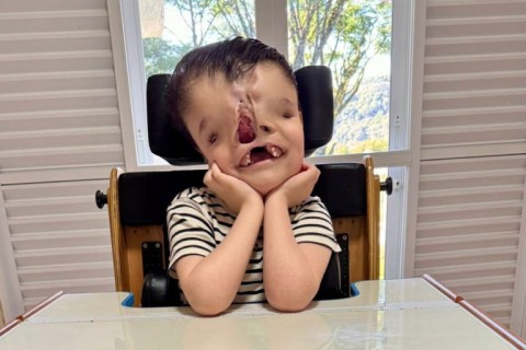 Menino com condição rara corre contra o tempo para arrecadar R$ 200 mil em SC